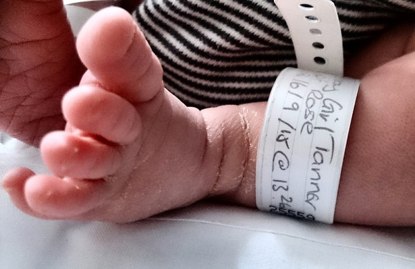 2015-09-16 Tilly foot